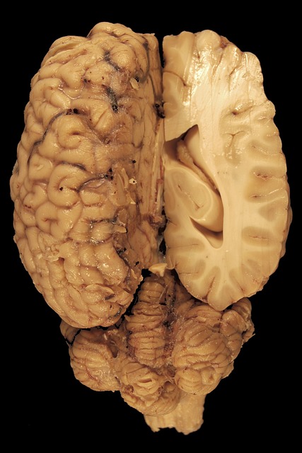 Struktura Mozkových komor: Podrobný‍ pohled na klíčové ⁤aspekty